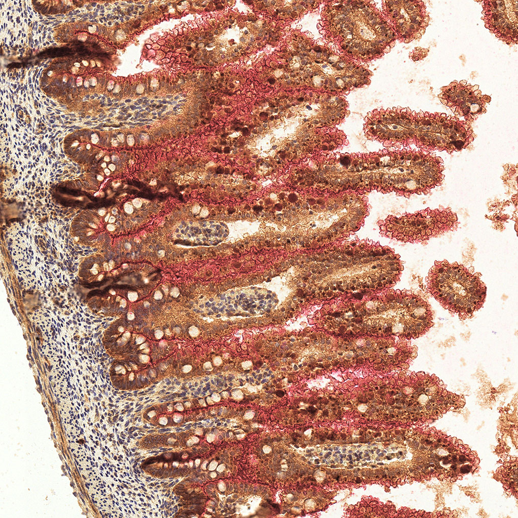 sars-cov-2 gene expression in a human fetus